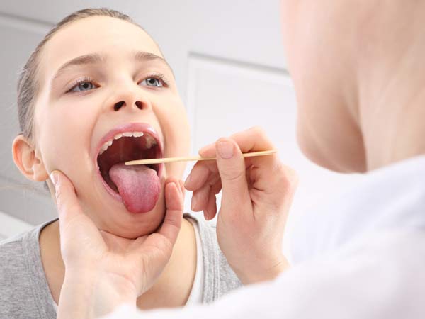 Bệnh viêm họng là bệnh lý về tai mũi họng